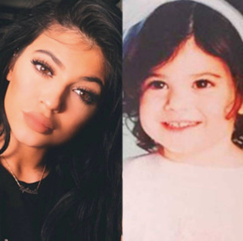 kylie jenner before after