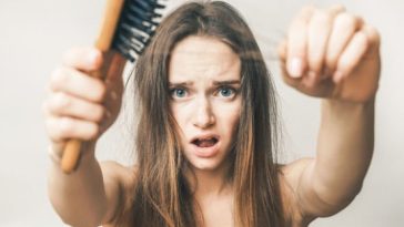Plants That Prevent Hair Loss (13 Most Effective Plants)