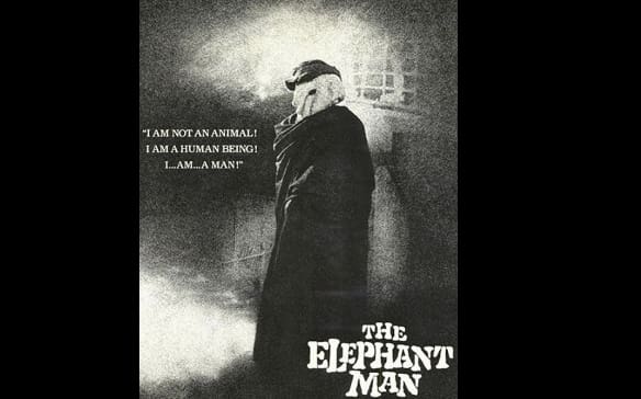 Best 20 The Elephant Man (1980) Quotes