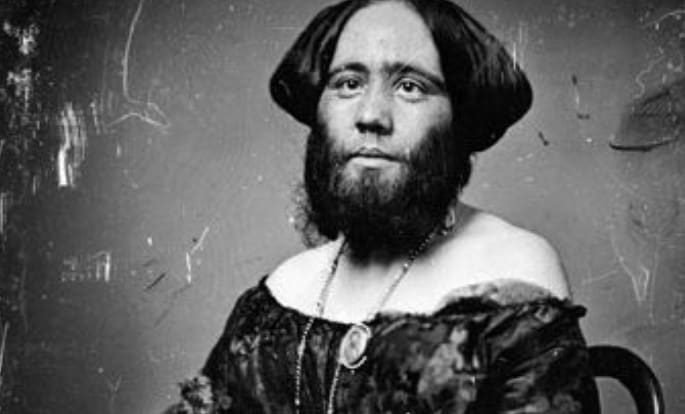 9 Rare Diseases Around the World