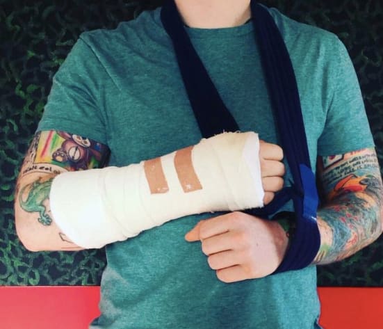 October 16 2017 Ed Sheeran breaks his wrist and elbow in a biking accident, forcing him to cancel dates on his tour of Asia.