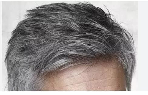 Will White Hair Turn Black Again