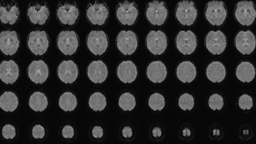 AI Breakthrough: Human Thoughts Translated Into Text 11 Human Thoughts Translated Into Text