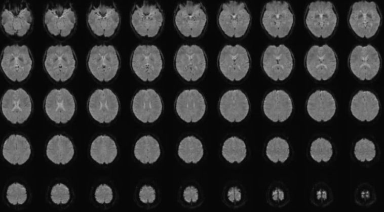 Human Thoughts Translated Into Text