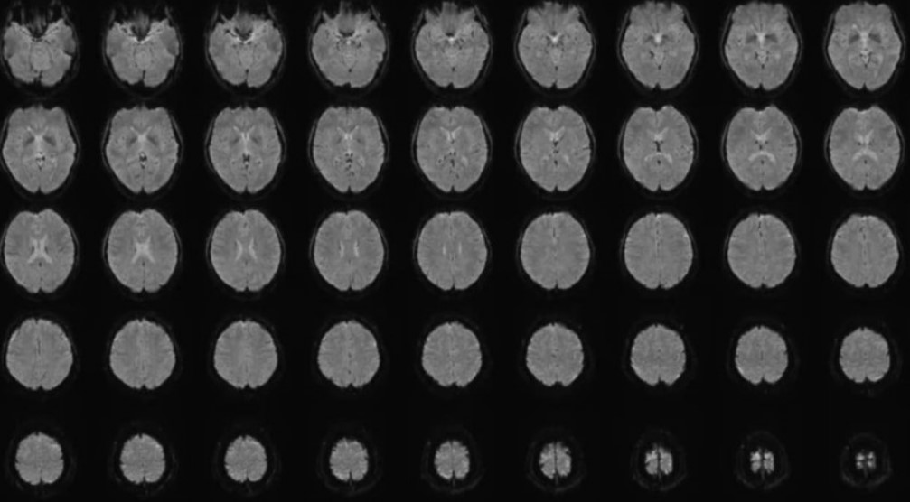 Human Thoughts Translated Into Text